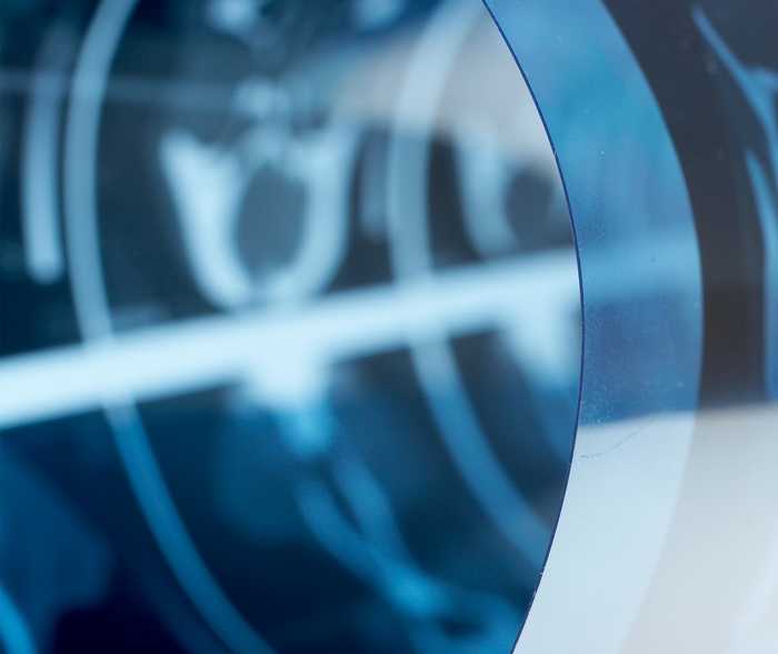 Leben mit NET: Die Peptidrezeptor-vermittelte Radionuklidtherapie (PRRT) ist eine relativ neue Therapie