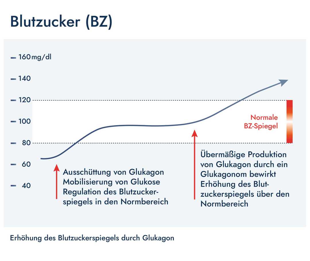 Grafik: Anstieg des Blutzuckers