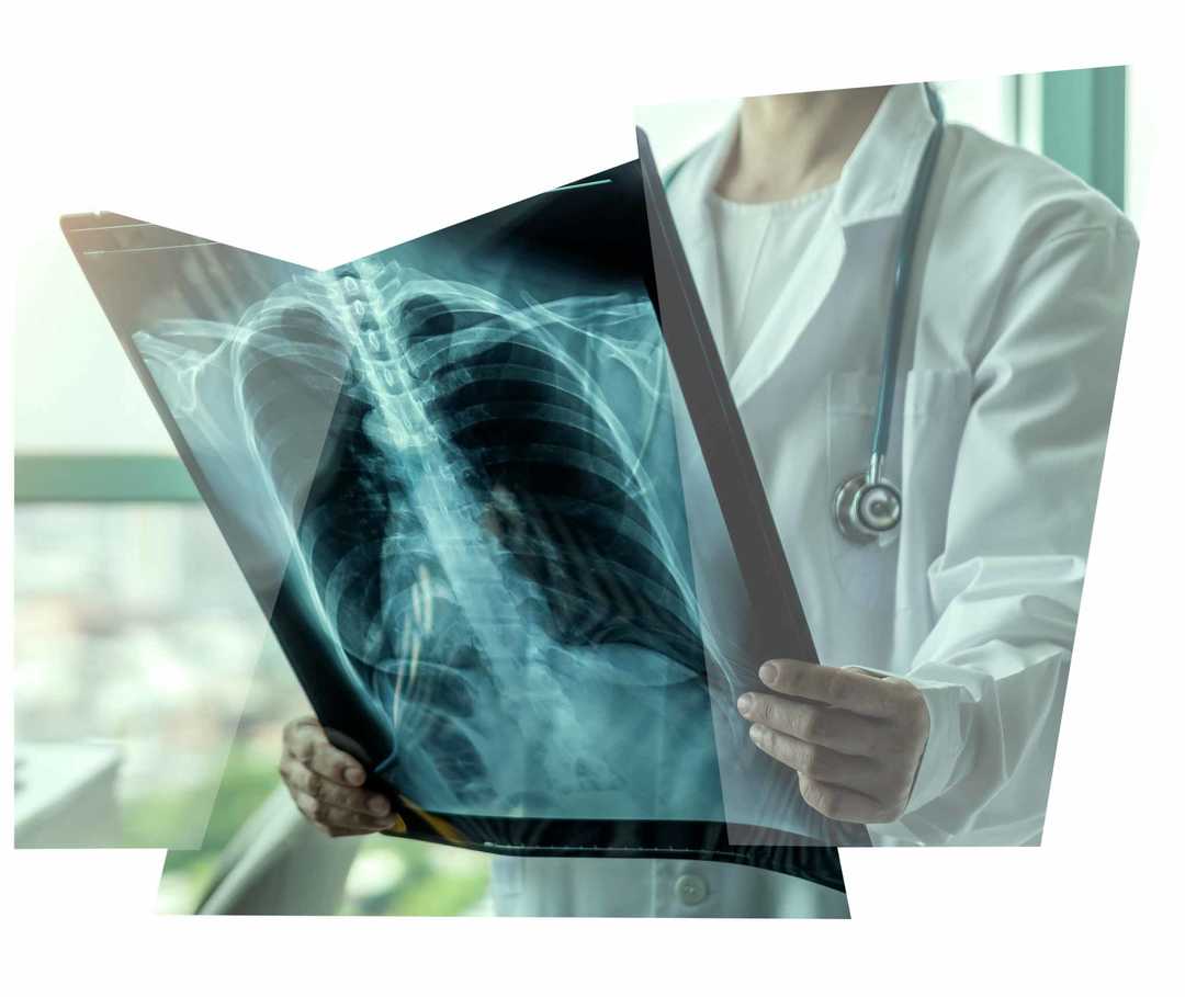 Leben mit NET: Eine Ärztin hält das Röntgenbild einer Lunge in den Händen