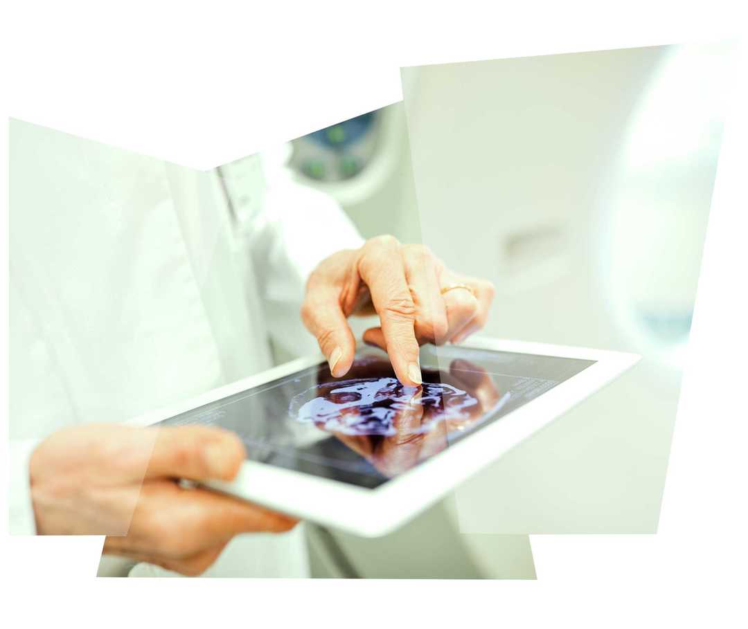 Leben mit NET: Ein Arzt schaut sich ein Tomografie-Diagnosebild eines Patienten an