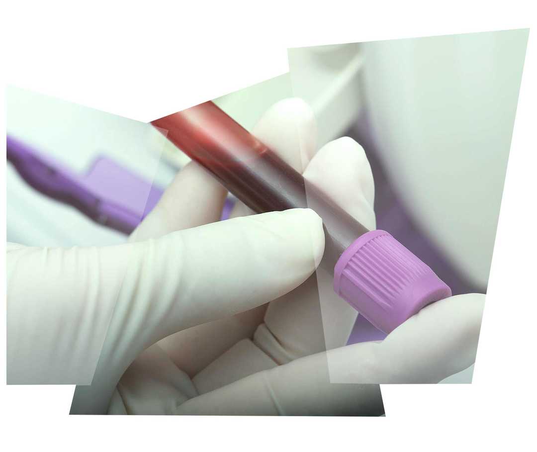Leben mit NET: Eine Laborsassistentin hält ein Röhrchen mit einer Blutprobe in der Hand Leben mit NET: Eine Laborsassistentin hält ein Röhrchen mit einer Blutprobe in der Hand