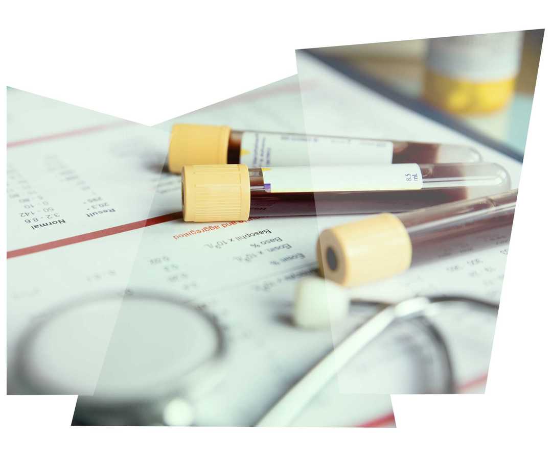 Leben mit NET: Blutproben eines Patienten liegen auf einem Labortisch
